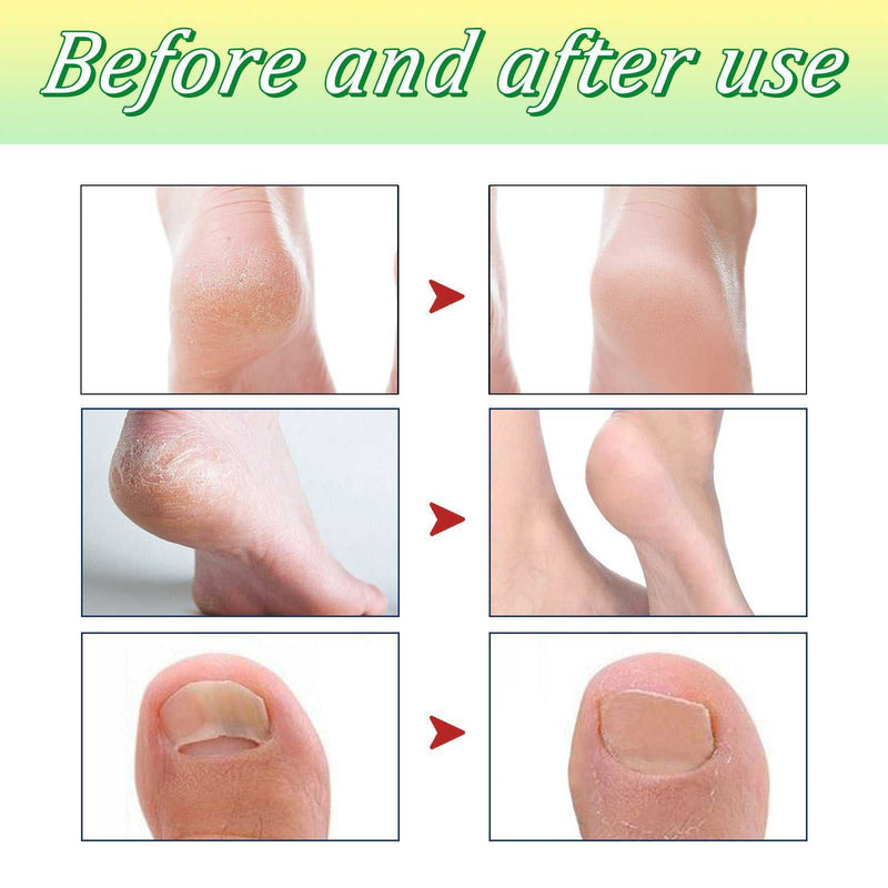 foot soak tablet dissolving in water